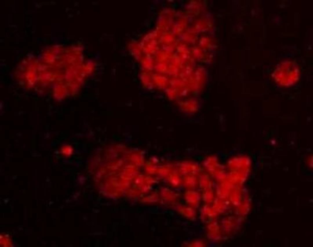 Immunofluorescent staining of A431 (red) Cells using EEA1-Early Endosome Marker antibody