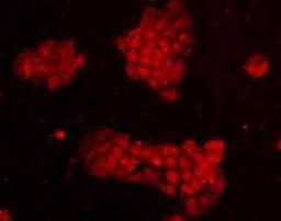 Immunofluorescent staining of A431 (red) Cells using EEA1-Early Endosome Marker antibody