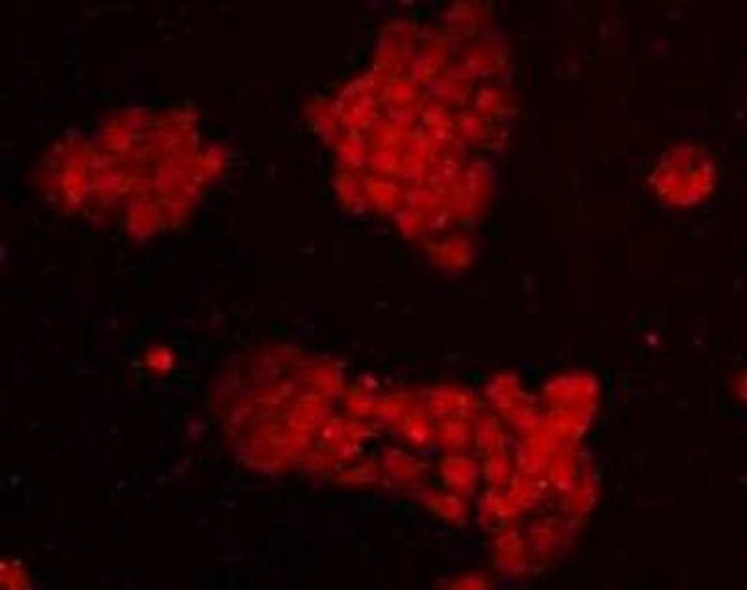 Immunofluorescent staining of A431 (red) Cells using EEA1-Early Endosome Marker antibody