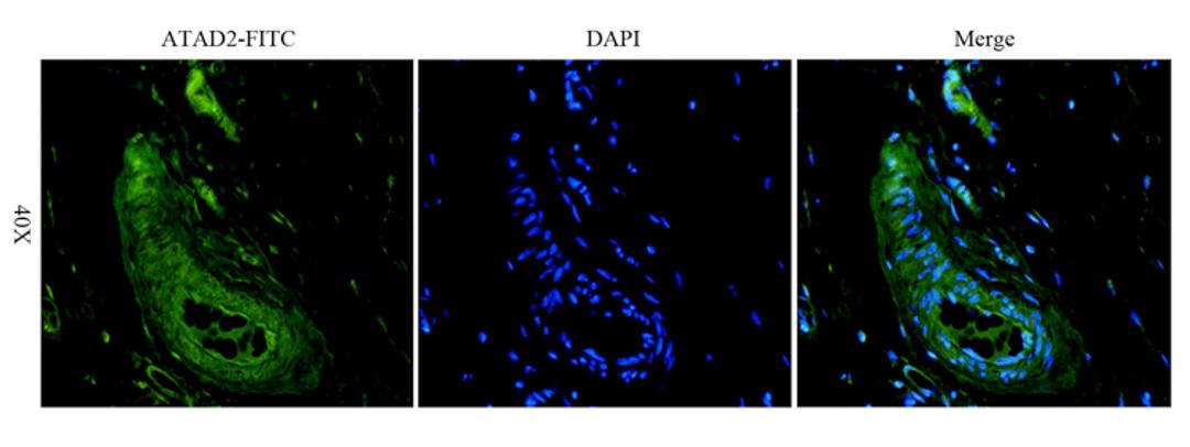 Immunofluorescence image of pig lung tissue using ATAD2 antibody (dilution at 1:100)