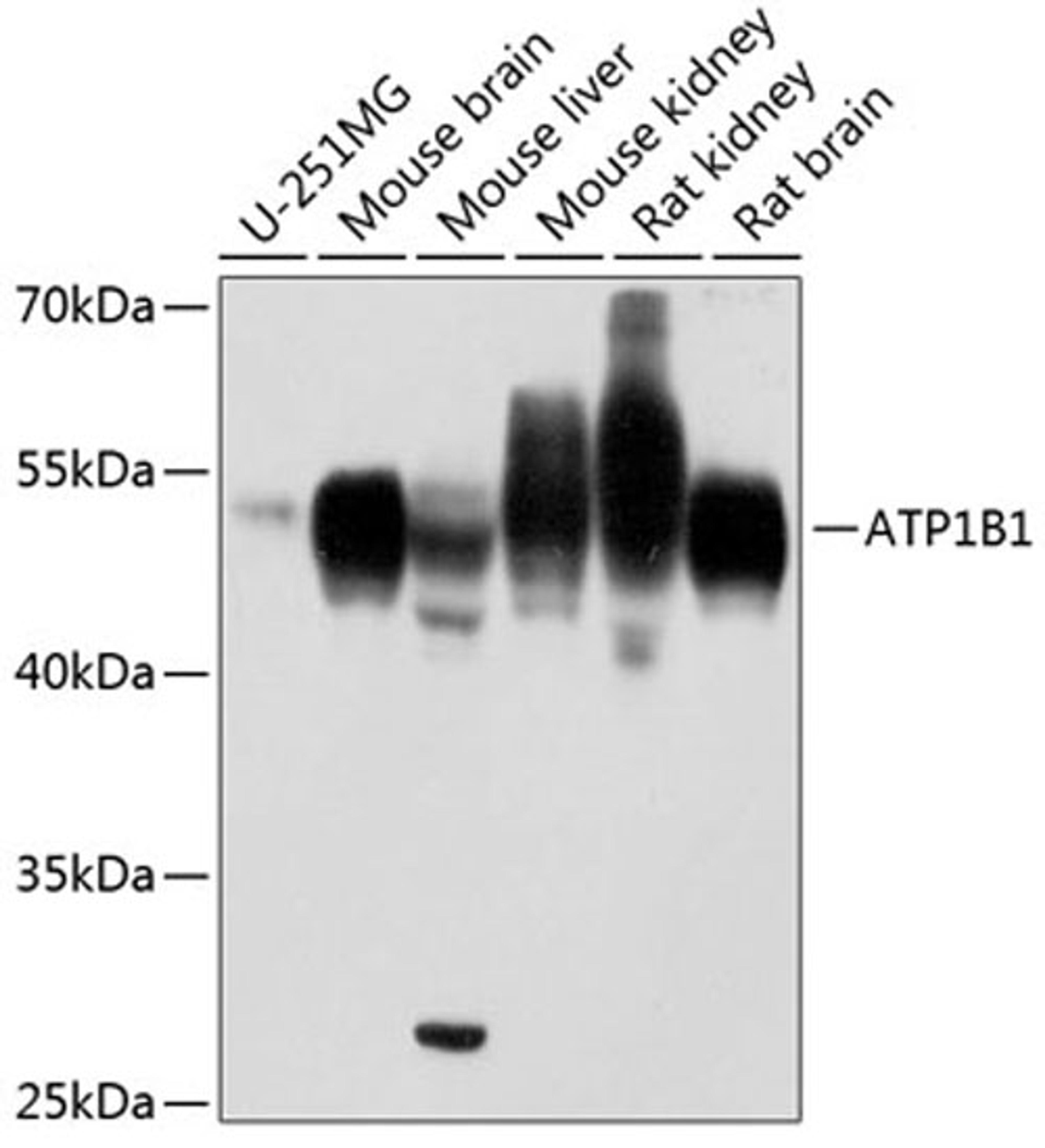 Western blot - ATP1B1 antibody (A12403)