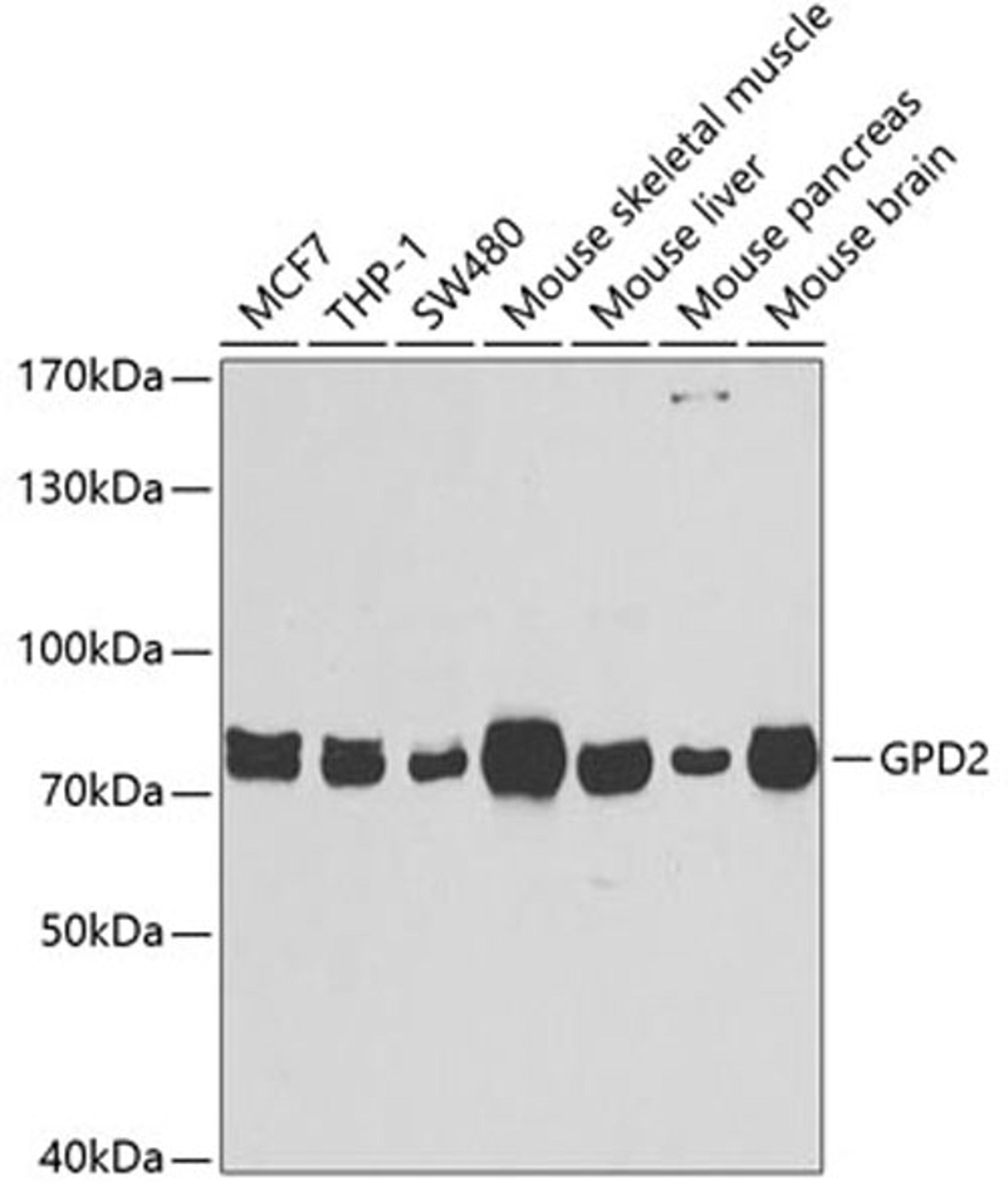 Western blot - GPD2 antibody (A6611)