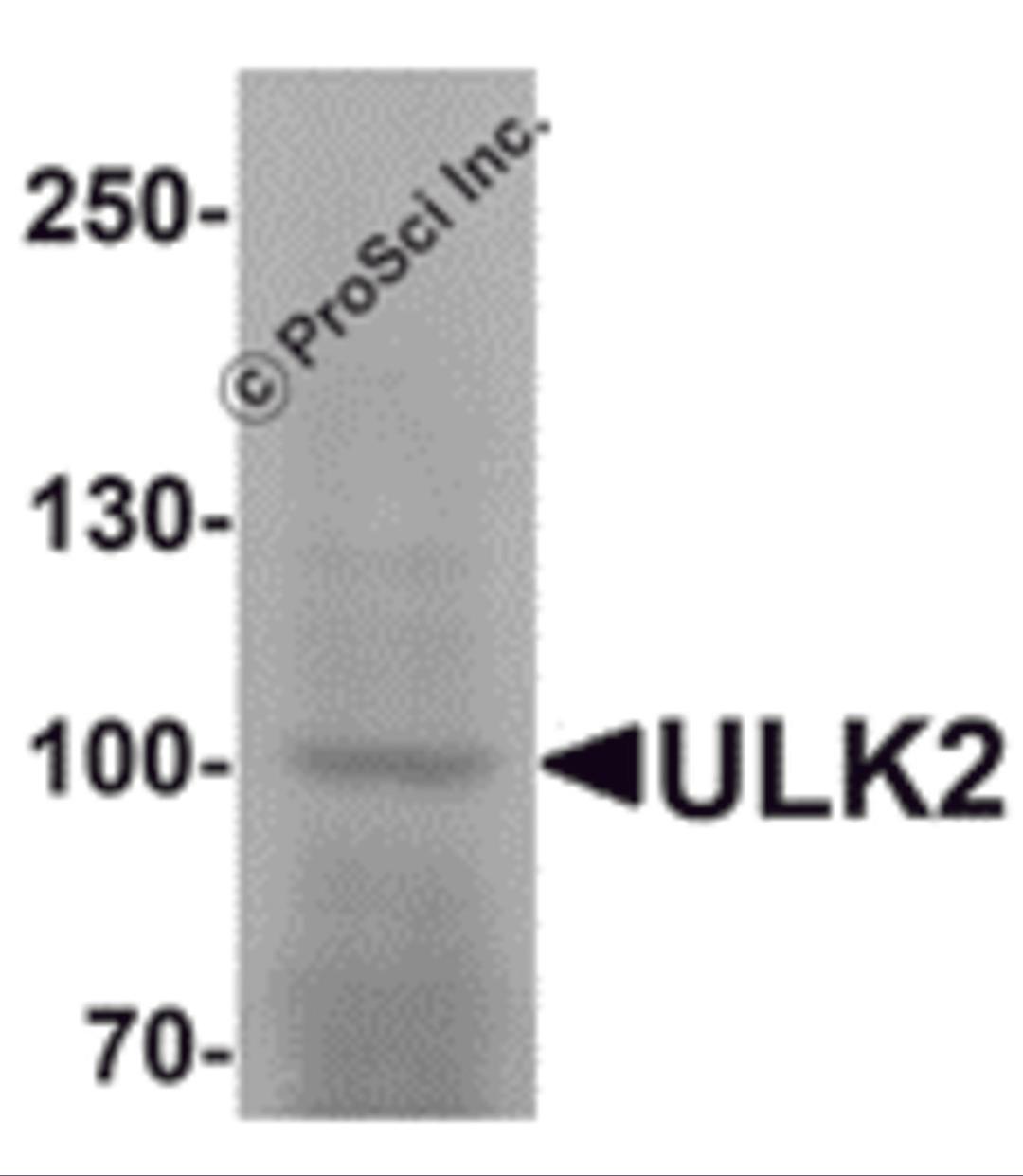 Western blot analysis of ULK2 in human brain tissue lysate with ULK2 antibody at 1 μg/mL.