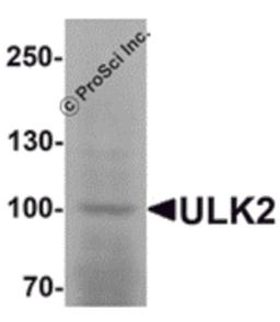 Western blot analysis of ULK2 in human brain tissue lysate with ULK2 antibody at 1 μg/mL.