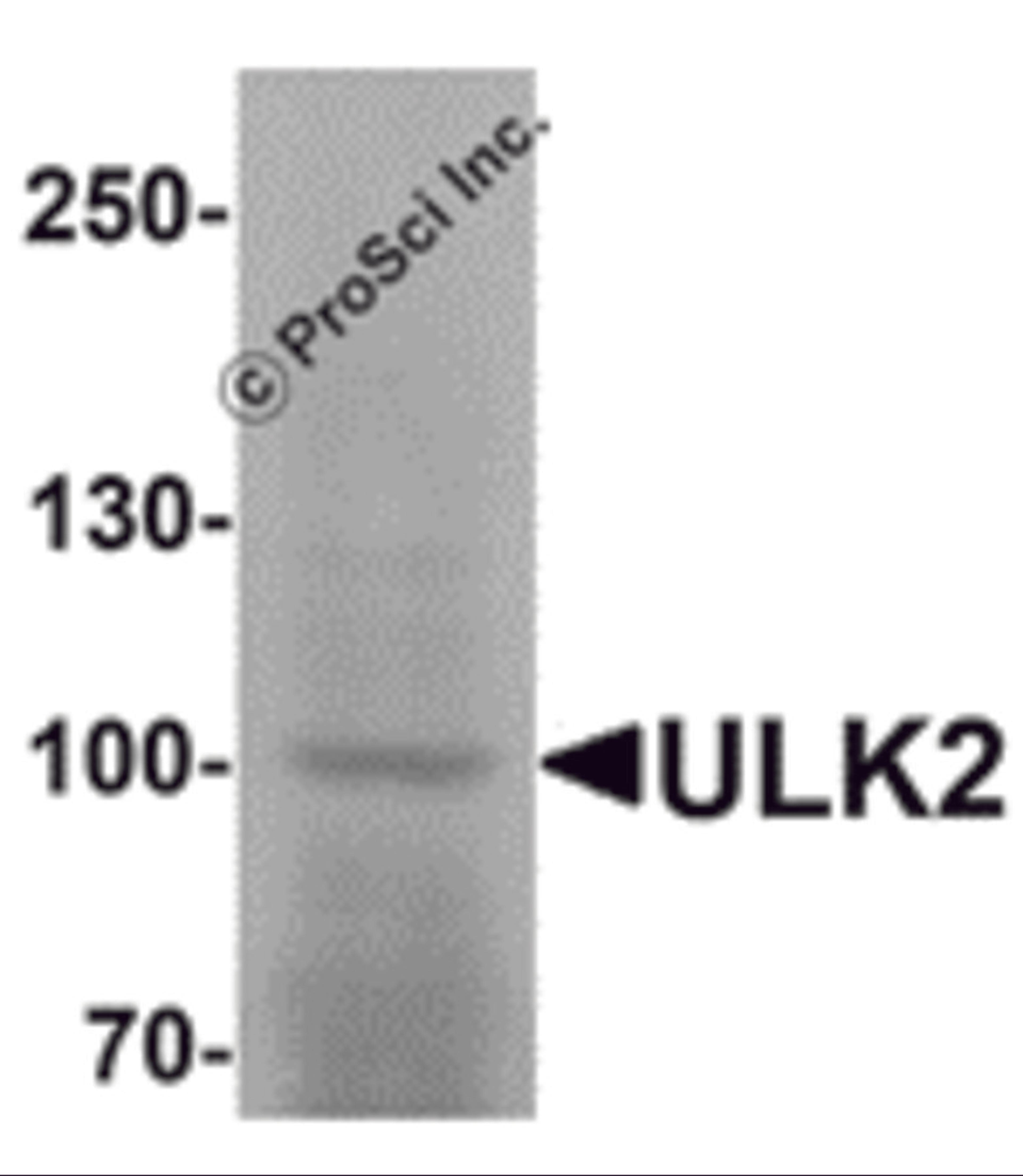 Western blot analysis of ULK2 in human brain tissue lysate with ULK2 antibody at 1 μg/mL.