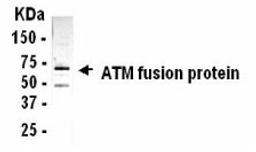 Western blot analysis of an E. coli derived ATM fusion protein using XW-7045 at a 1:2,000 dilution. The fusion protein contained only a domain of 85 amino acids. The fusion partner is about 53kDa. The fusion protein size is approximately 63kDa.