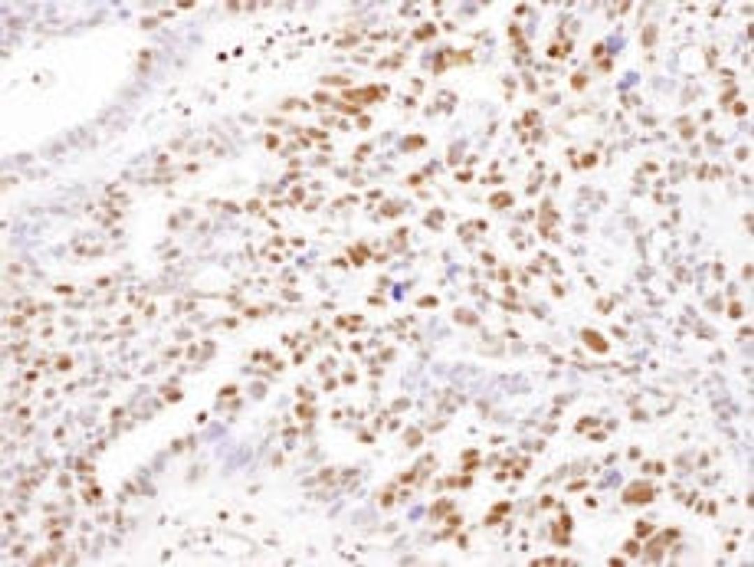 Detection of human SAMHD1 by immunohistochemistry.