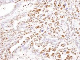 Detection of human SAMHD1 by immunohistochemistry.