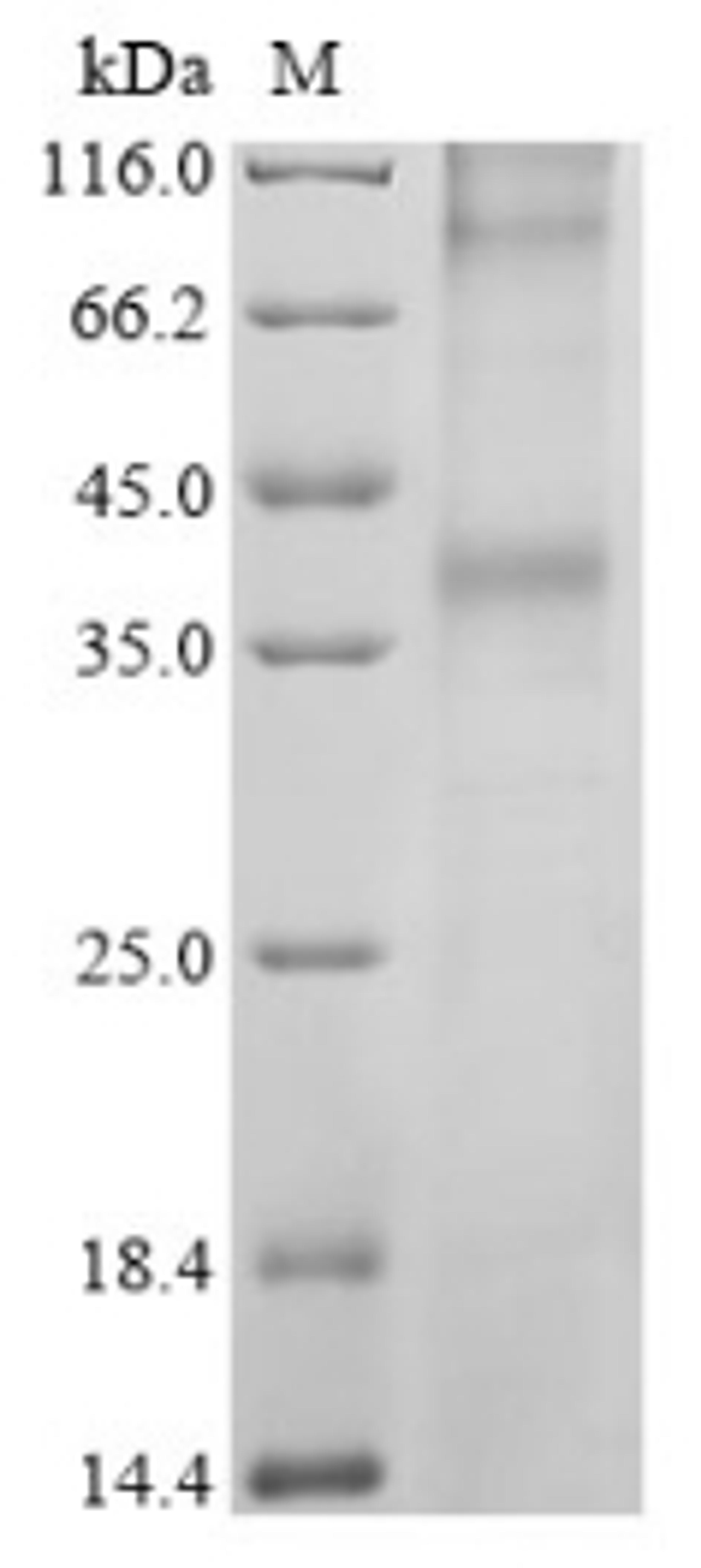 (Tris-Glycine gel) Discontinuous SDS-PAGE (reduced) with 5% enrichment gel and 15% separation gel.