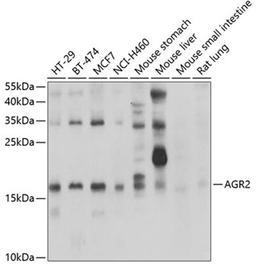 Western blot - AGR2 antibody (A7064)