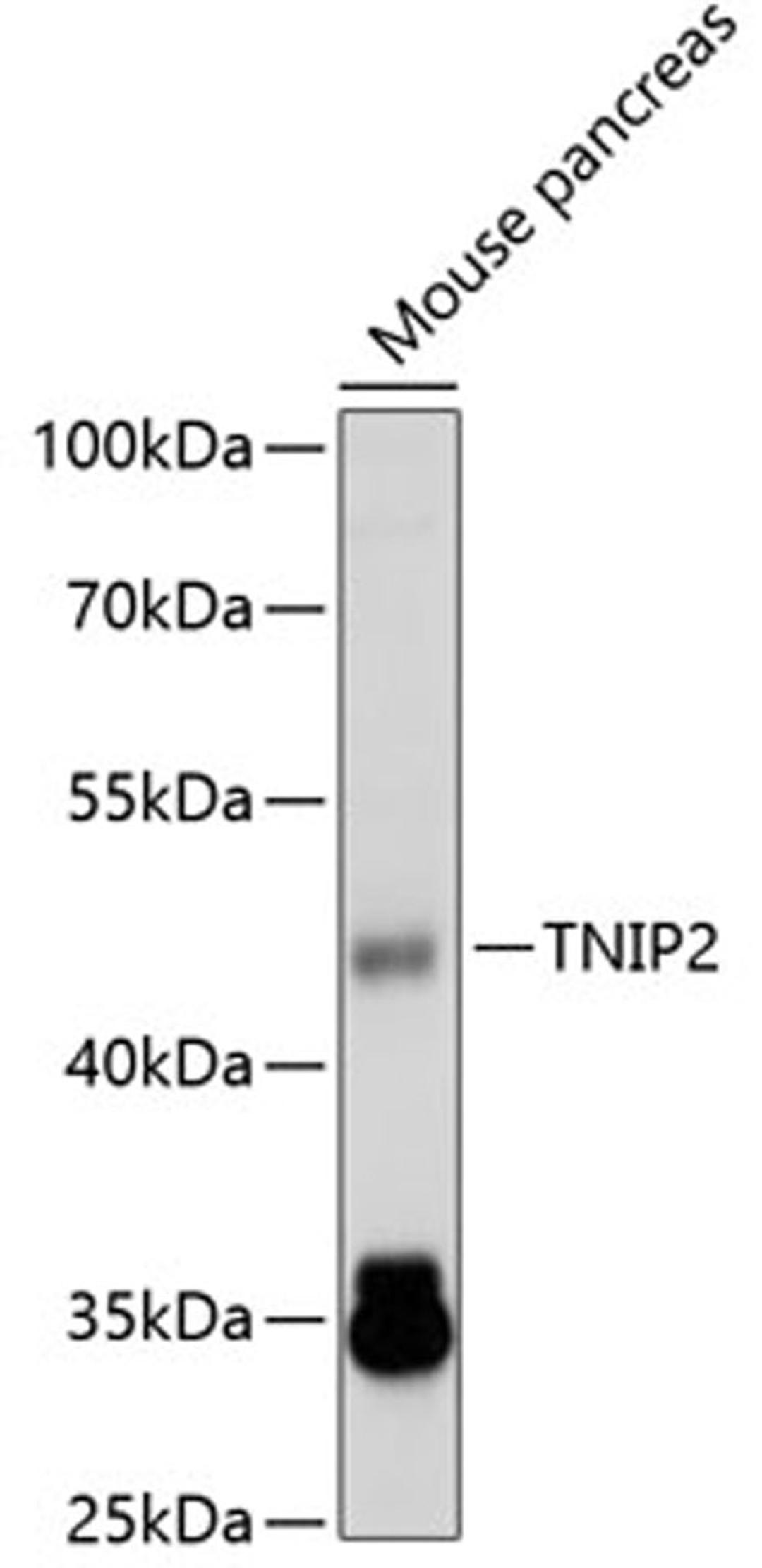 Western blot - TNIP2 antibody (A4962)