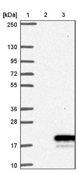 Western Blot: CARTPT Antibody [NBP1-91749] - Lane 1: Marker [kDa] 250, 130, 95, 72, 55, 36, 28, 17, 10<br/>Lane 2: Negative control (vector only transfected HEK293T lysate)<br/>Lane 3: Over-expression lysate (Co-expressed with a C-terminal myc-DDK tag (~3.1 kDa) in mammalian HEK293T cells, LY418081)