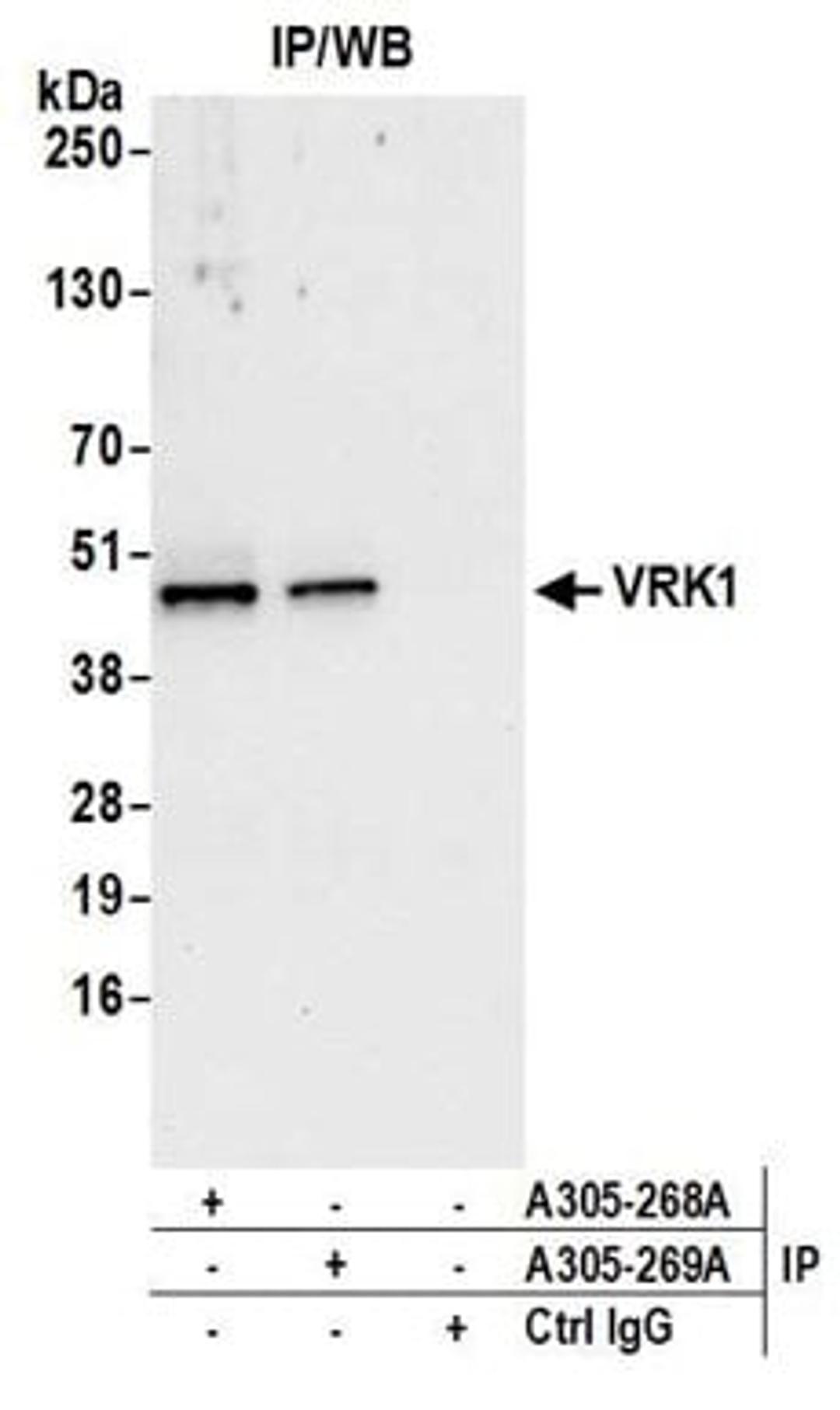 Detection of human VRK1 by western blot of immunoprecipitates.