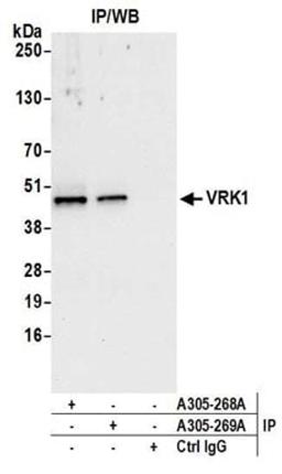 Detection of human VRK1 by western blot of immunoprecipitates.