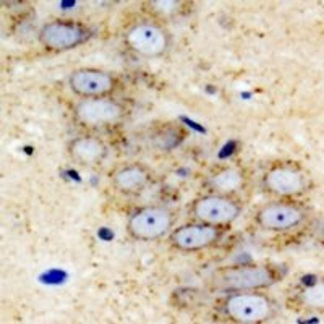 Immunohistochemical staining of mouse brain tissue using IGFBP5 antibody