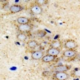 Immunohistochemical staining of mouse brain tissue using IGFBP5 antibody