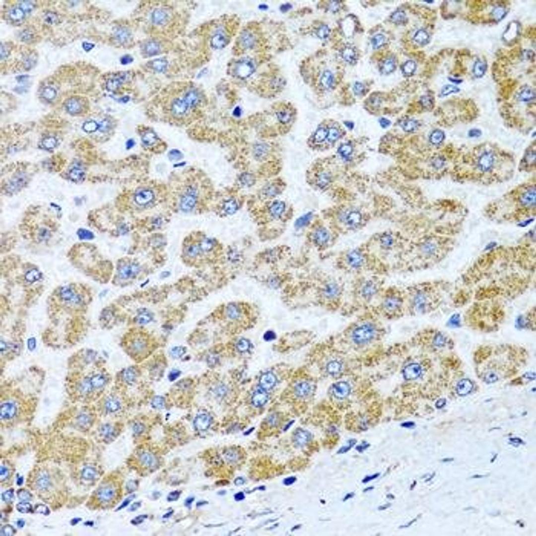 Immunohistochemical staining of rat lung tissue using COL10A1 antibody (dilution of 1:100)