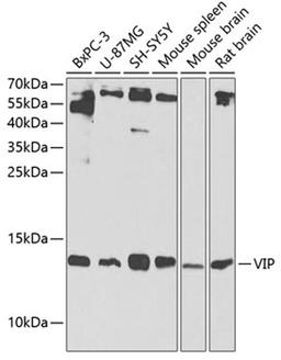 Western blot - VIP Antibody (A1804)