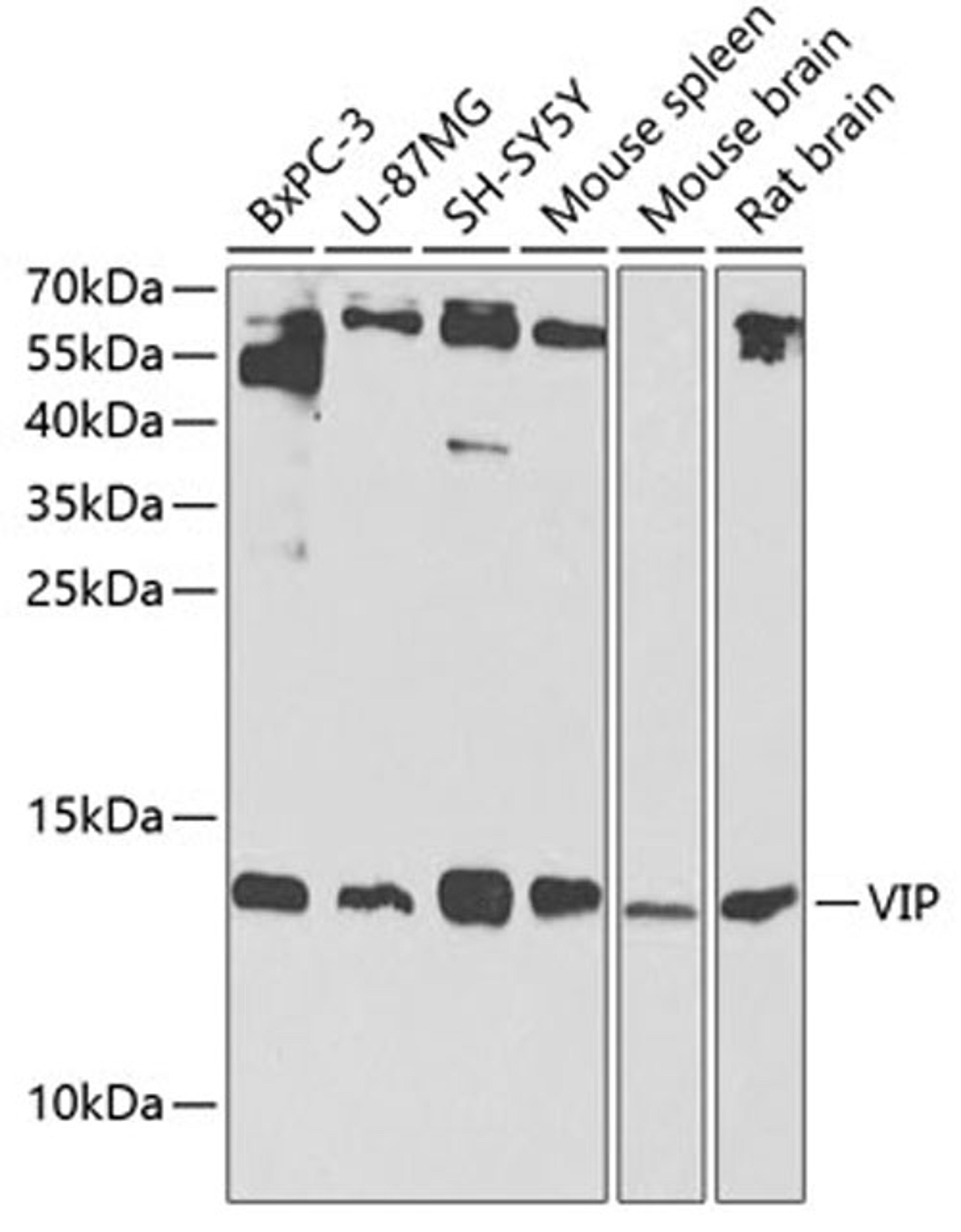 Western blot - VIP Antibody (A1804)