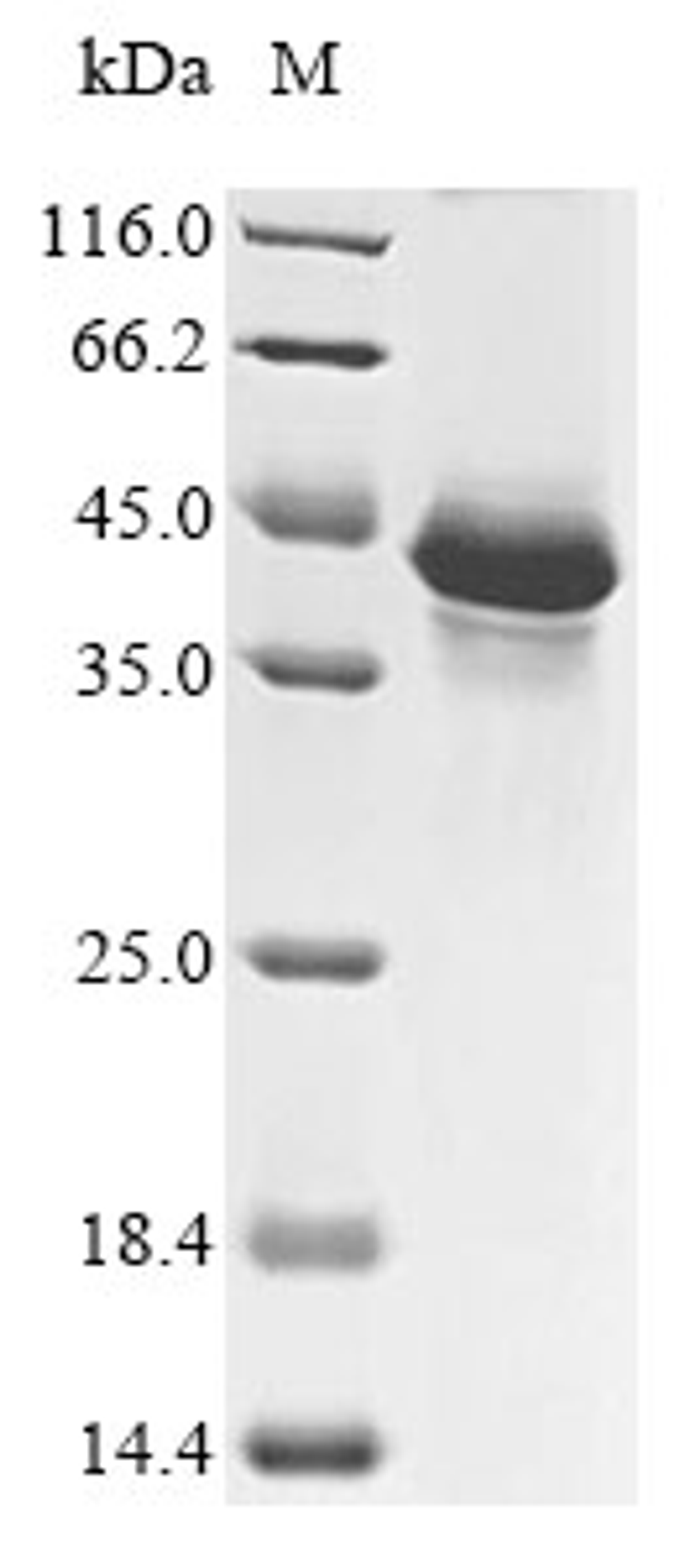 (Tris-Glycine gel) Discontinuous SDS-PAGE (reduced) with 5% enrichment gel and 15% separation gel.