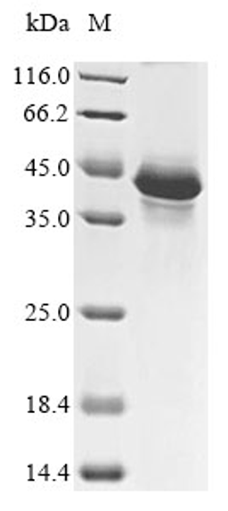 (Tris-Glycine gel) Discontinuous SDS-PAGE (reduced) with 5% enrichment gel and 15% separation gel.