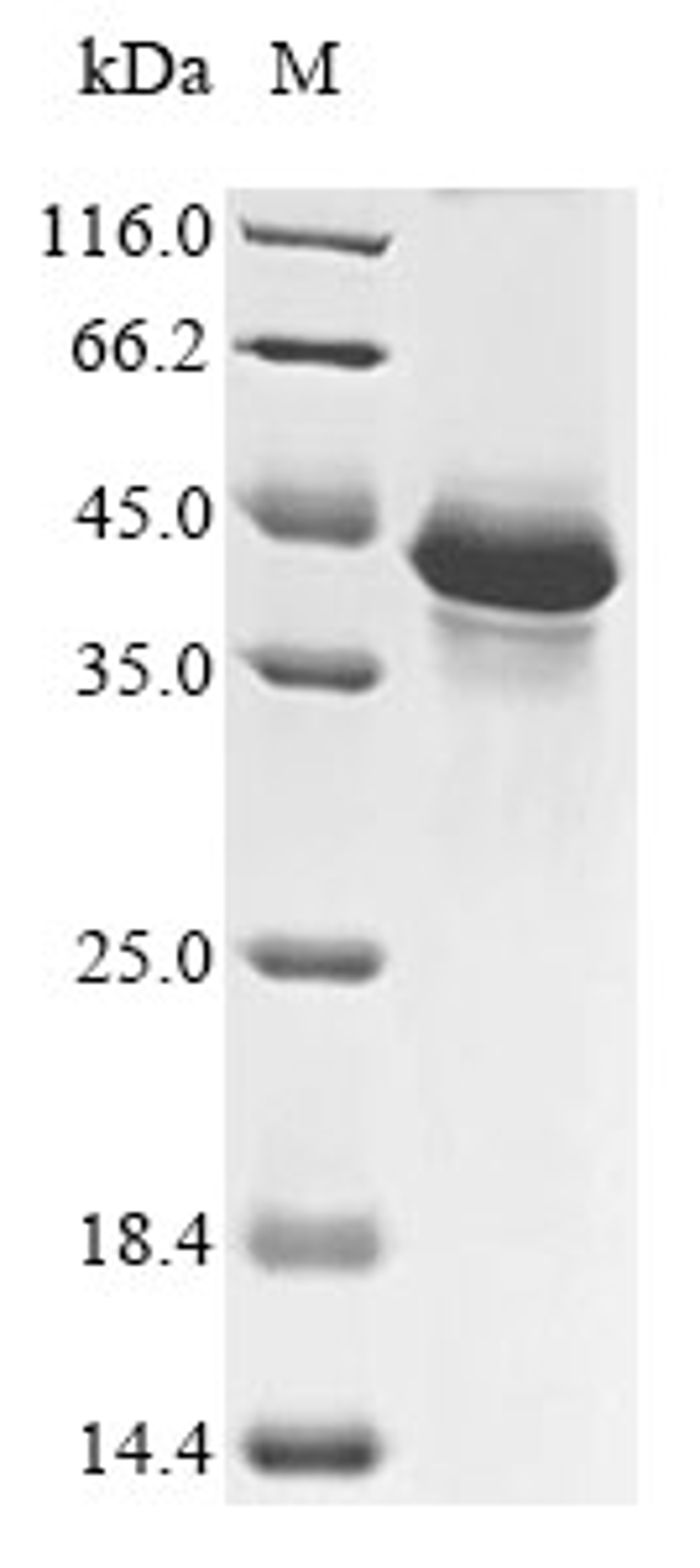 (Tris-Glycine gel) Discontinuous SDS-PAGE (reduced) with 5% enrichment gel and 15% separation gel.