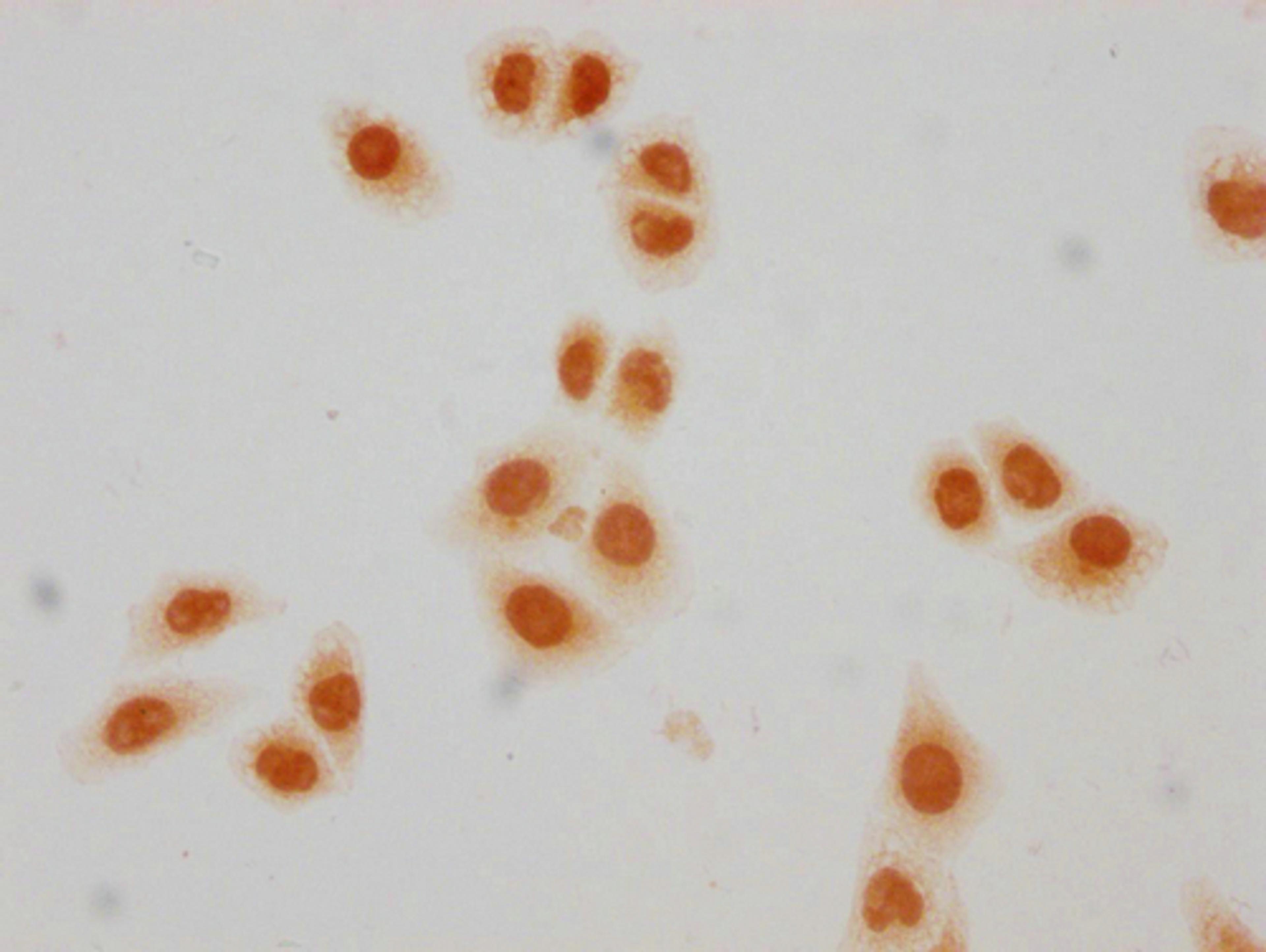 Immunocytochemistry analysis of CSB-PA010403PA23crHU diluted at 1:50 and staining in Hela cells(treated with 30mM sodium crotonylate for 4h) performed on a Leica BondTM system. The cells were fixed in 4% formaldehyde, permeabilized using 0.2% Triton X-100 and blocked with 10% normal goat serum 30min at RT. Then primary antibody (1% BSA) was incubated at 4°C overnight. The primary is detected by a biotinylated secondary antibody and visualized using an HRP conjugated SP system.