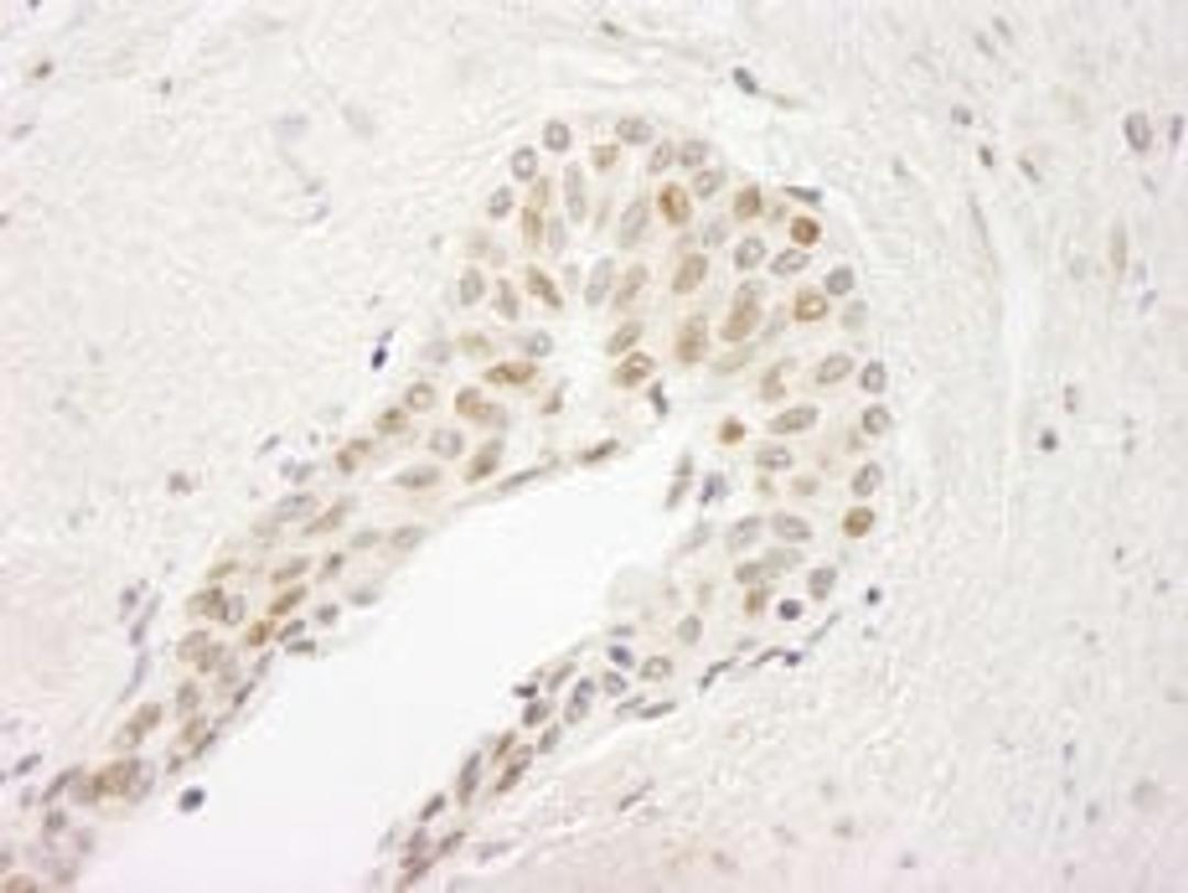 Detection of human ATRIP by immunohistochemistry.