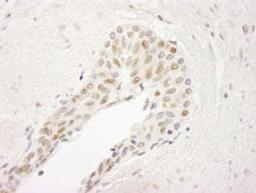 Detection of human ATRIP by immunohistochemistry.