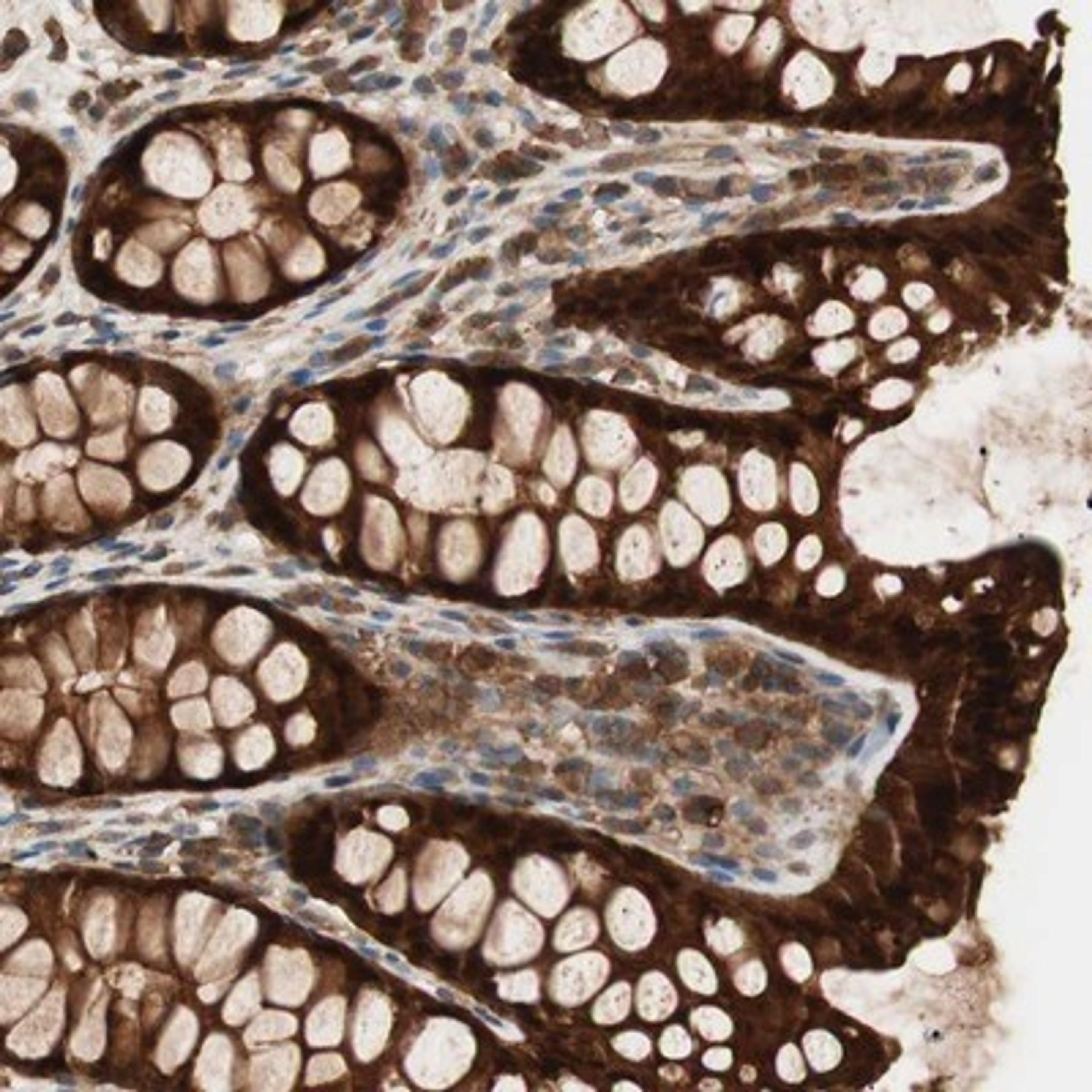 Immunohistochemistry-Paraffin: GALE Antibody [NBP1-87066] - Staining of human colon shows strong cytoplasmic and nuclear positivity in glandular cells.