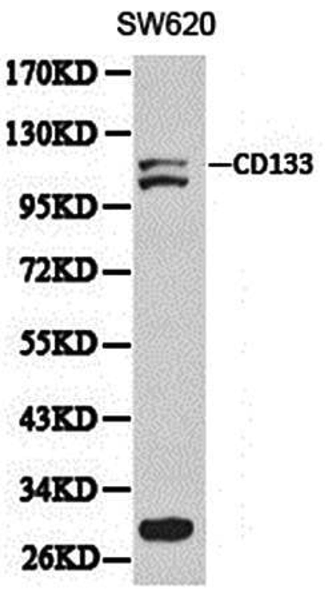 Western blot analysis of extracts of SW620 cell line lysates using CD133 antibody