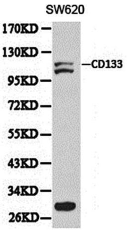 Western blot analysis of extracts of SW620 cell line lysates using CD133 antibody