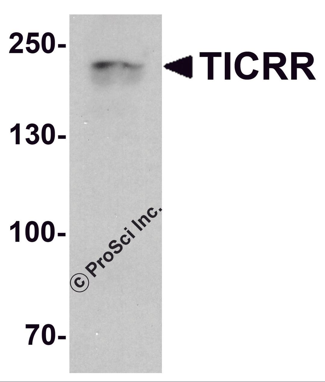 Western blot analysis of TICRR in human small intestine tissue lysate with TICRR antibody at 1 &#956;g/ml.