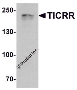 Western blot analysis of TICRR in human small intestine tissue lysate with TICRR antibody at 1 μg/ml.
