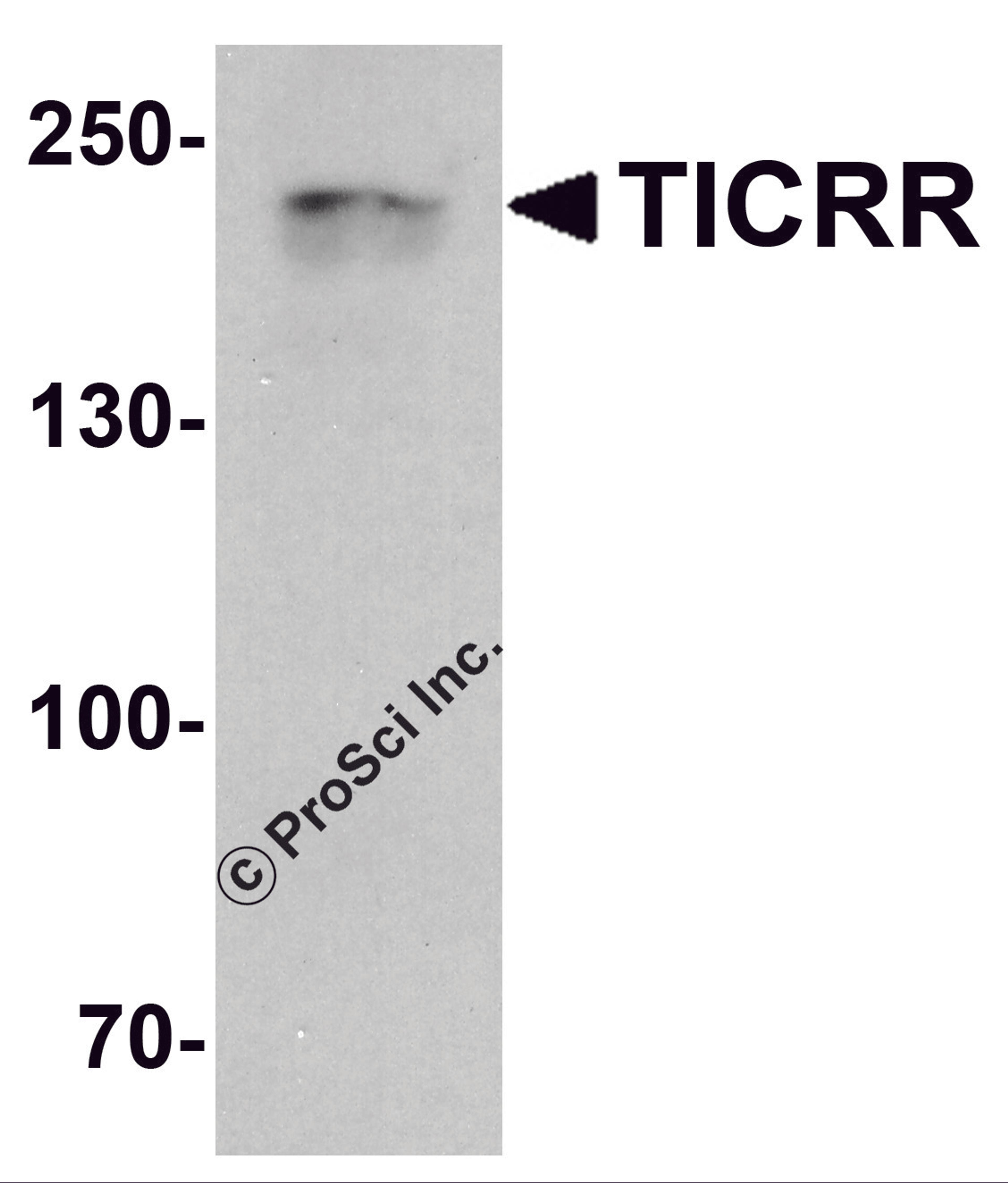 Western blot analysis of TICRR in human small intestine tissue lysate with TICRR antibody at 1 μg/ml.