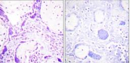 Immunohistochemistry-Paraffin: PPAR gamma/NR1C3 Antibody [NBP1-61399] - Analysis of paraffin-embedded human placenta tissue, using PPAR-gamma Antibody. The picture on the right is blocked with the synthesized peptide.