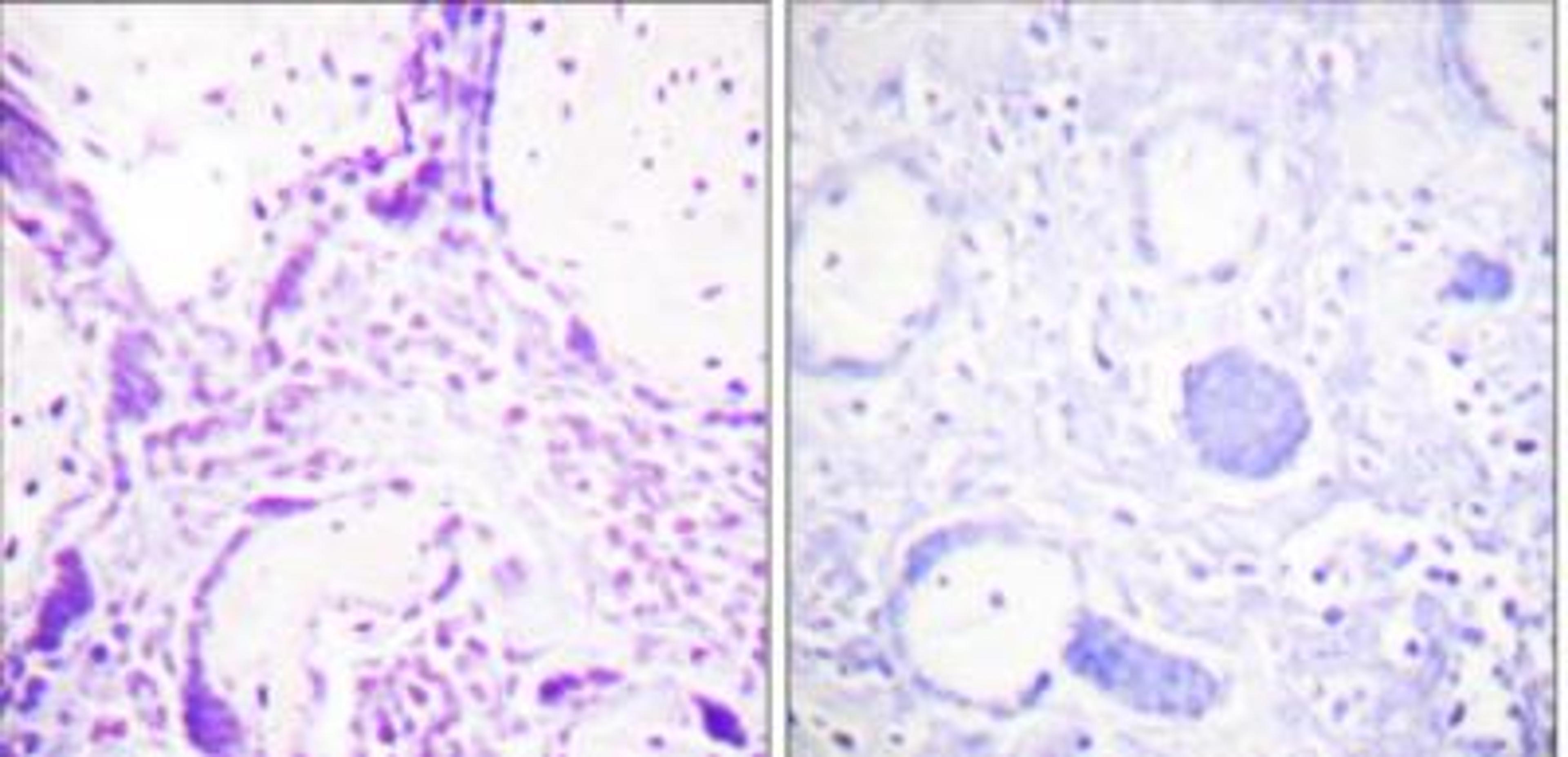 Immunohistochemistry-Paraffin: PPAR gamma/NR1C3 Antibody [NBP1-61399] - Analysis of paraffin-embedded human placenta tissue, using PPAR-gamma Antibody. The picture on the right is blocked with the synthesized peptide.