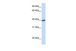 Antibody used in WB on Human Heart at 0.2-1 ug/ml.