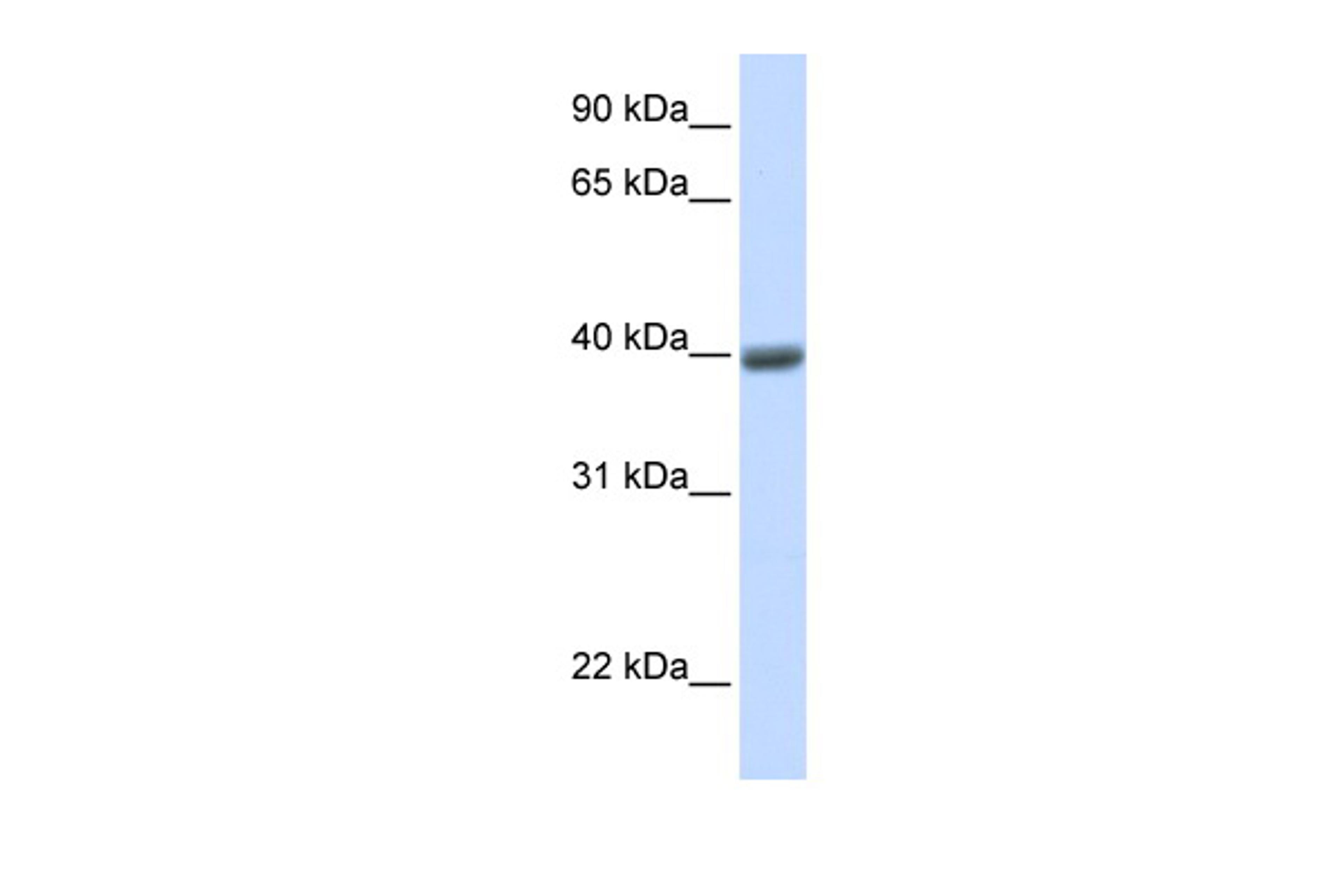 Antibody used in WB on Human Heart at 0.2-1 ug/ml.