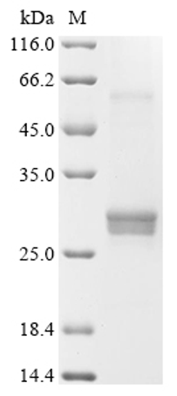 (Tris-Glycine gel) Discontinuous SDS-PAGE (reduced) with 5% enrichment gel and 15% separation gel.