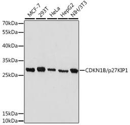 Western blot - CDKN1B/p27KIP1 antibody (A16633)