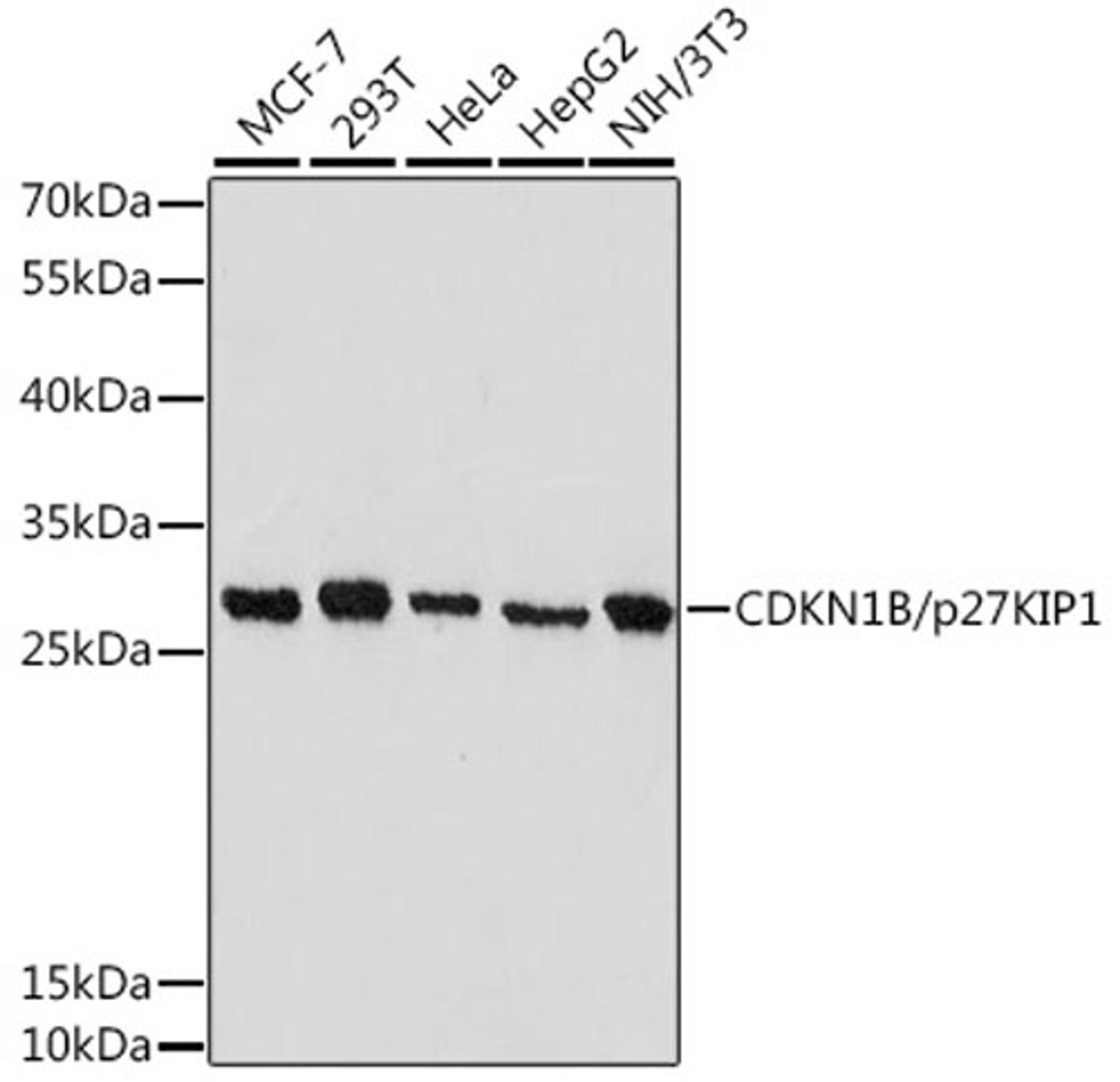 Western blot - CDKN1B/p27KIP1 antibody (A16633)