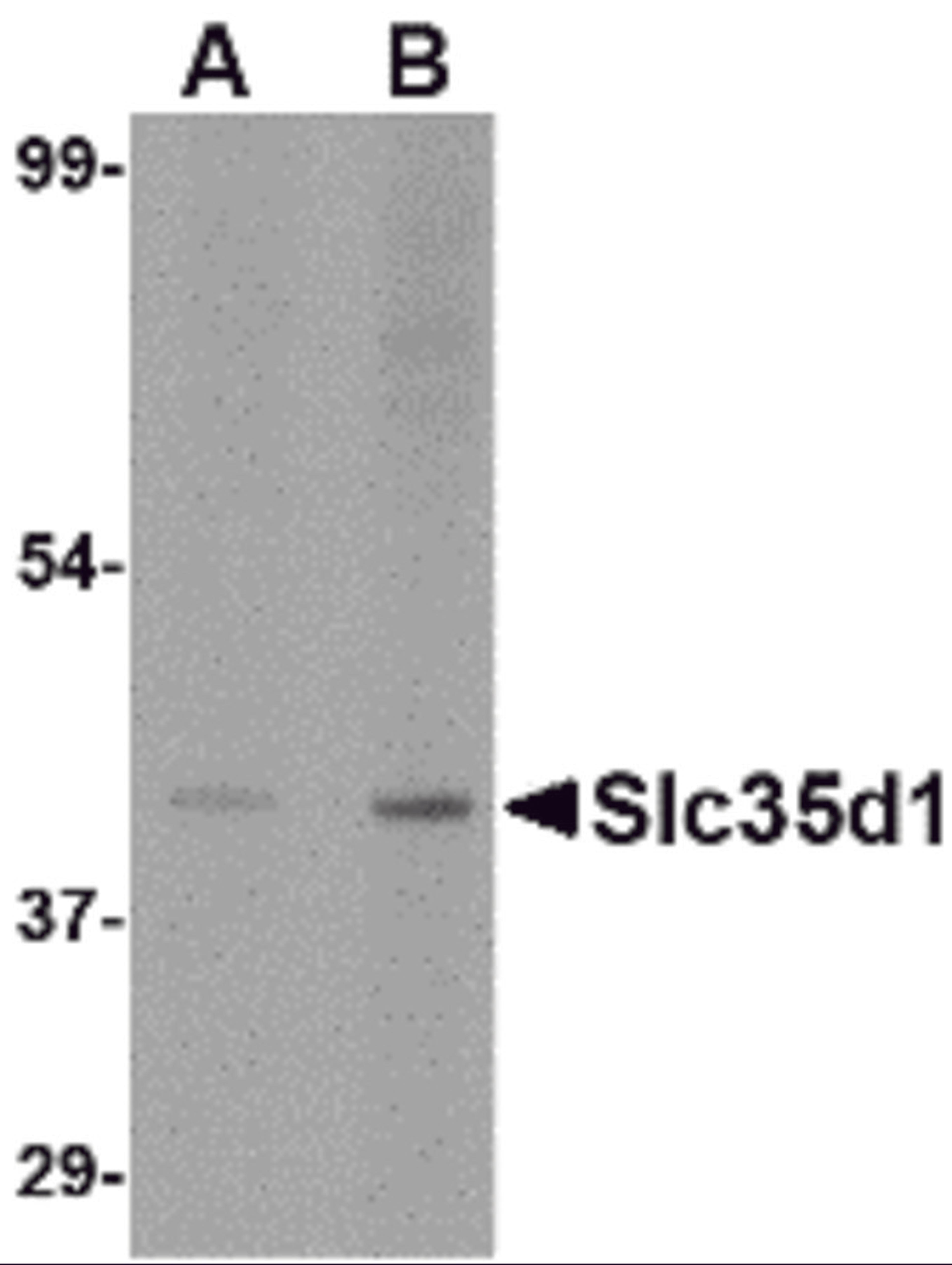 Western blot analysis of Slc35D1 inA-20 lysate with Slc35D1 antibody at (A) 1 and (B) 2 &#956;g/mL.