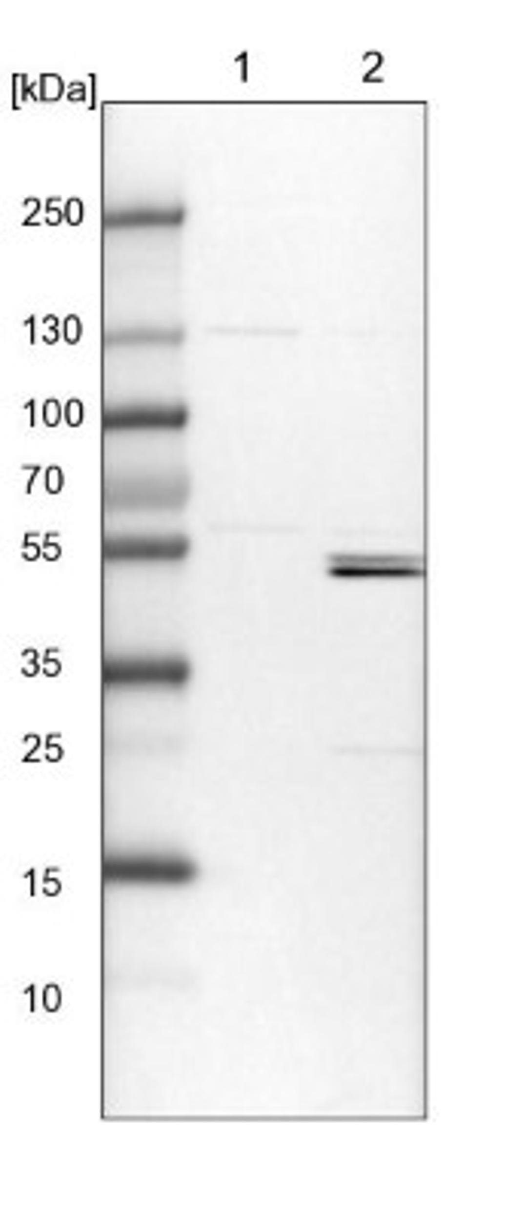 Western Blot: KLHL7 Antibody [NBP1-82871] - Lane 1: NIH-3T3 cell lysate (Mouse embryonic fibroblast cells)<br/>Lane 2: NBT-II cell lysate (Rat Wistar bladder tumour cells)