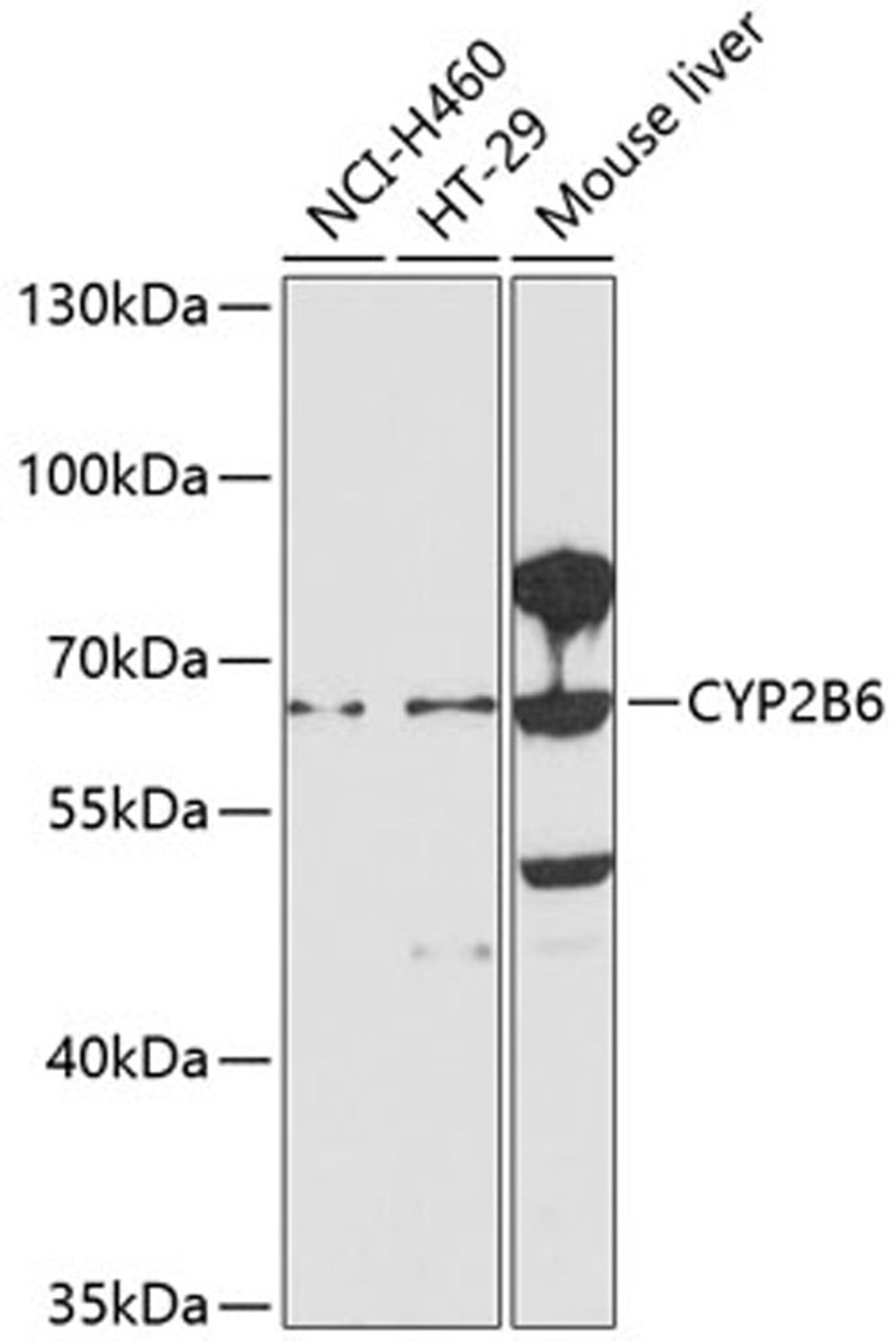 Western blot - CYP2B6 antibody (A1463)