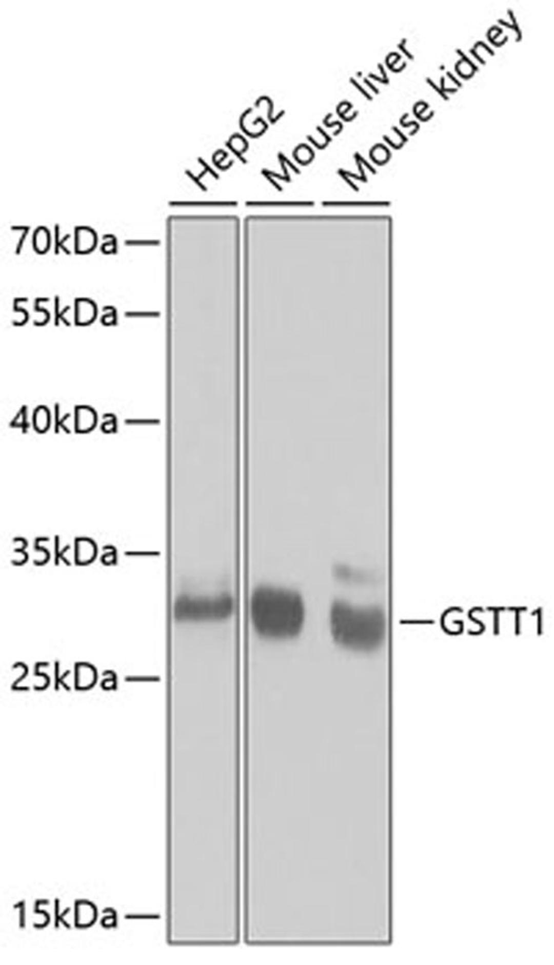 Western blot - GSTT1 antibody (A1287)