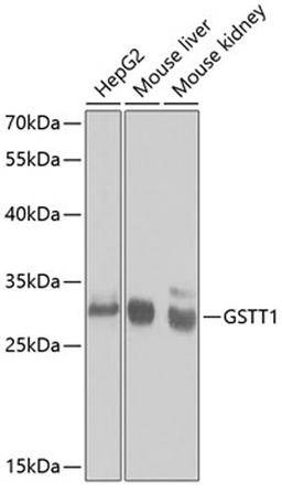 Western blot - GSTT1 antibody (A1287)