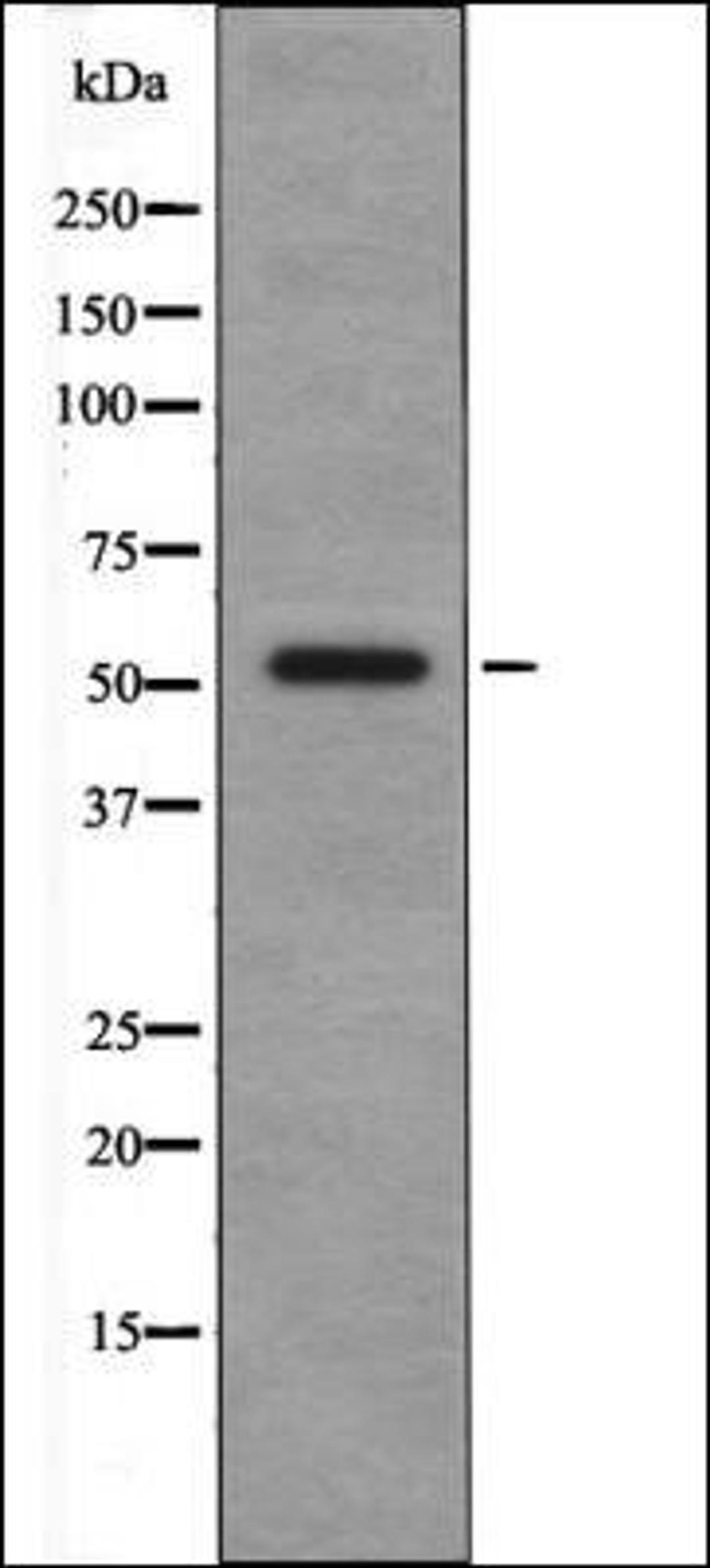 Western blot analysis of Insulin treated HeLa whole cell lysates using CSK -Phospho-Tyr304- antibody