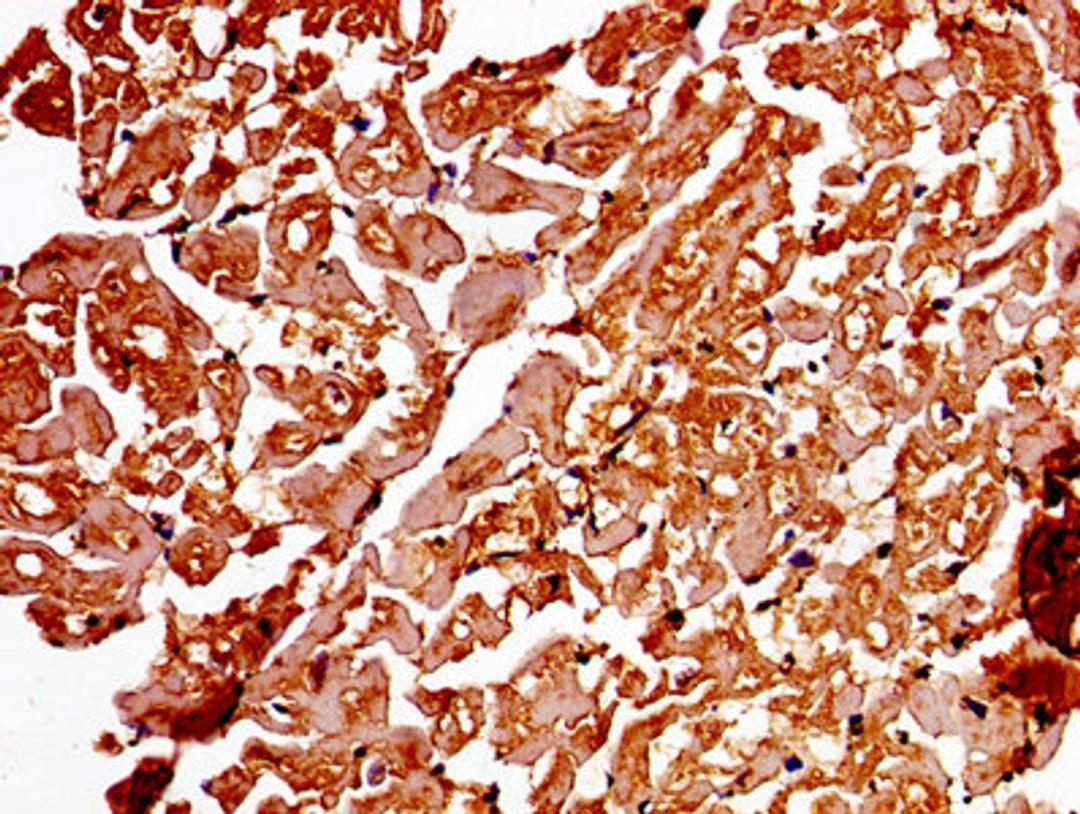 Immunohistochemistry of paraffin-embedded human heart tissue using CSB-PA001311LA01HU at dilution of 1:100