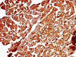 Immunohistochemistry of paraffin-embedded human heart tissue using CSB-PA001311LA01HU at dilution of 1:100